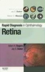 Retina