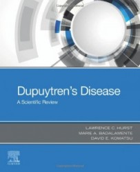 Dupuytren's Disease : A Scientific Review