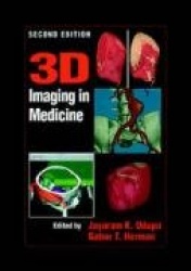 3D Imaging in Medicine, Second Edition
