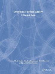 Oncoplastic Breast Surgery - A Practical Guide