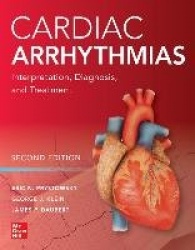 Cardiac Arrhythmias: Interpretation, Diagnosis and Treatment, Second Edition