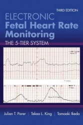 Electronic Fetal Heart Rate Monitoring: the 5-Tier System - The 5-Tier System