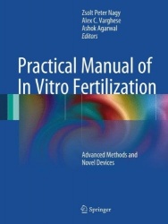 Practical Manual of In Vitro Fertilization - Advanced Methods and Novel Devices