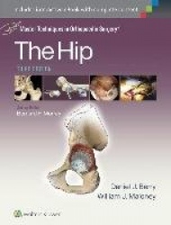 Master Techniques in Orthopaedic Surgery: The Hip