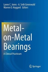 Metal-on-Metal Bearings : A Clinical Practicum