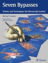 Seven Bypasses - Tenets and Techniques for Revascularization