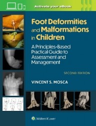 Foot Deformities and Malformations in Children - A Principles-Based, Practical Guide to Assessment and Management: Print + eBook