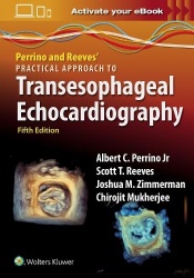 Perrino and Reeves'Practical Approach to Transesophageal Echocardiography