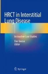 HRCT in Interstitial Lung Disease : Instructive Case Studies