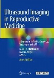 Ultrasound Imaging in Reproductive Medicine : Advances in Infertility Work-up, Treatment and ART