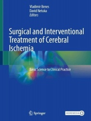 Surgical and Interventional Treatment of Cerebral Ischemia - Basic Science to Clinical Practice