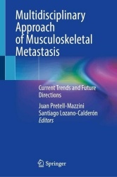 Multidisciplinary Approach of Musculoskeletal Metastasis : Current Trends and Future Directions