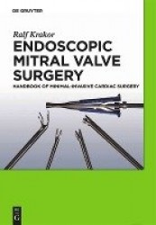 Endoscopic Mitral Valve Surgery - Handbook of Minimal-invasive Cardiac Surgery