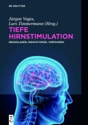 Tiefe Hirnstimulation - Grundlagen, Indikationen, Verfahren