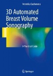 3D Automated Breast Volume Sonography : A Practical Guide