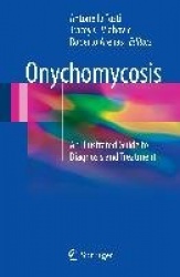 Onychomycosis : An Illustrated Guide to Diagnosis and Treatment