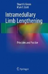 Intramedullary Limb Lengthening : Principles and Practice