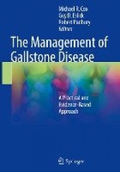 The Management of Gallstone Disease - A Practical and Evidence-Based Approach