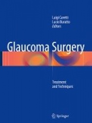Glaucoma Surgery : Treatment and Techniques