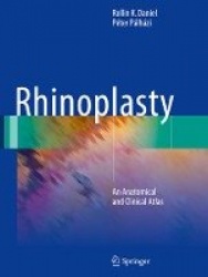 Rhinoplasty - An Anatomical and Clinical Atlas
