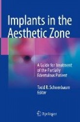 Implants in the Aesthetic Zone : A Guide for Treatment of the Partially Edentulous Patient