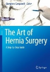 The Art of Hernia Surgery - A Step-by-Step Guide