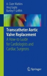 Transcatheter Aortic Valve Replacement : A How-to Guide for Cardiologists and Cardiac Surgeons