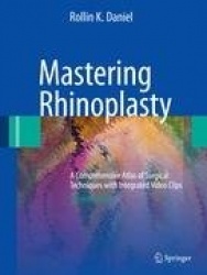 Mastering Rhinoplasty : A Comprehensive Atlas of Surgical Techniques with Integrated Video Clips
