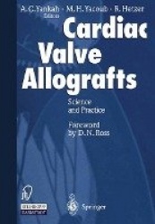 Cardiac Valve Allografts - Science and Practice