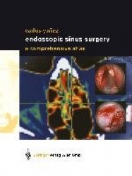 Endoscopic Sinus Surgery : A Comprehensive Atlas