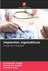 Implantes zigomáticos