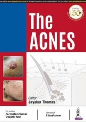 The Acnes