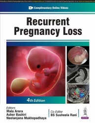 Recurrent Pregnancy Loss
