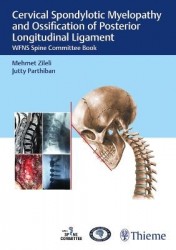 Cervical Spondylotic Myelopathy and Ossification - WFNS Spine Committee Book
