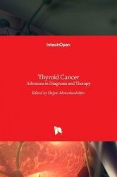 Thyroid Cancer - Advances in Diagnosis and Therapy