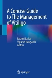A Concise Guide to The Management of Vitiligo