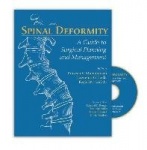 Spinal Deformity - A Guide to Surgical Planning and Management